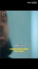 詹嫂说：詹姆斯恢复身体的高压氧舱像棺材，声音也很吵